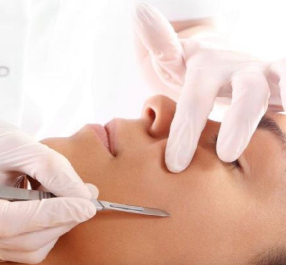 Dermaplaning $70